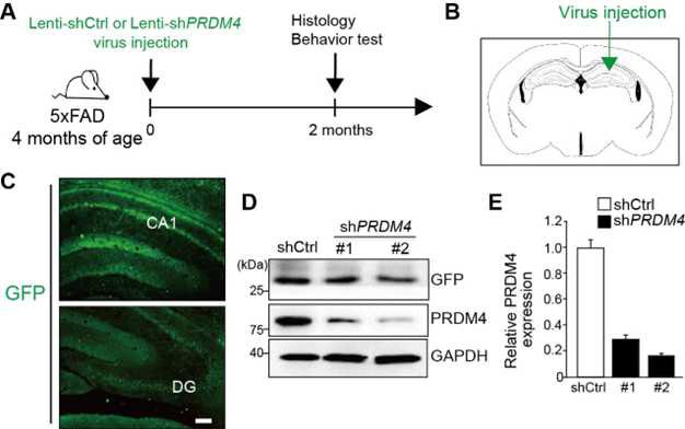 5xFAD 치매 동물모델 해마 조직에 주입한 Lenti-shPRDM4 바이러스에 의해 PRDM4 단백질의 Knock-down 정도 확인. PRDM4 단백질이 정상인보다 발현이 높은 것을 immunoblot 실험 방법으로 확인 함. (A) Experimental scheme. (B) Stereotaxic frame을 통한 치매동물 모델 5xFAD의 해마 CA1[AP: ML: DV] 부위에 Lenti-shCtrl/Lenti-shPRDM4주입. (C) Immunohistochemistry를 통해서 Lenti-GFP virus가 5XFAD 해마 부위에 잘 발현 하고 있음을 확인함. (D, E) Immunoblot을 통해서 Lenti-shPRDM4 virus에 의해서 PRDM4 단백질 발현이 감소됨을 확인함.