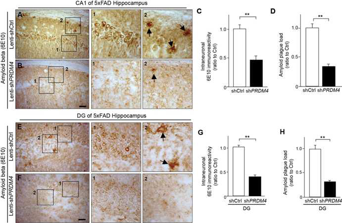 치매 동물모델인 5XFAD mouse에서 amyloid beta 축적 정도 확인. Lenti-Ctrl 을 주입한 5XFAD 마우스 해마보다 Lenti-shPRDM4 바이러스를 주입한 5XFAD 마우스 hippocamppus(A-D), DG(E-H)에 amyloid-beta축적 정고다 줄어들었음을 IHC을 통해서 확인함.