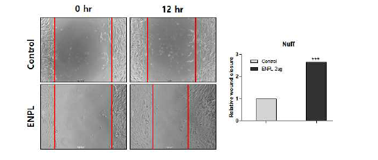 외재적 ENPL 자극 후 wound healing assay를 통한 세포 이동성 확인
