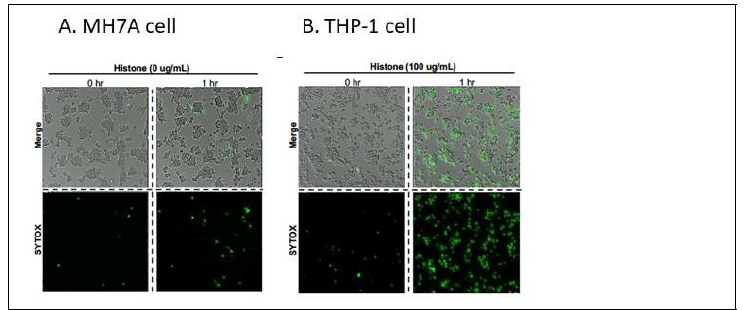 Histone cytotoxicity in macrophage. Histone 투여후 1시간후 Sytox로 cell을 염색후 측 정함.