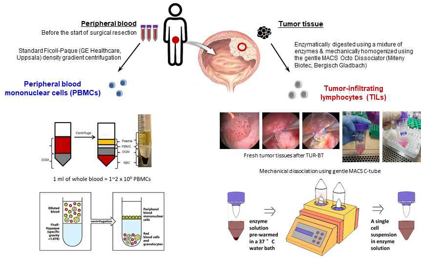 방광암의 혈액 및 조직내 면역세포 추출 비교 연구
