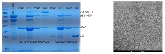 IP3R-GRO75-VDAC 복합체의 발현 정제 및 negative staining EM 실험