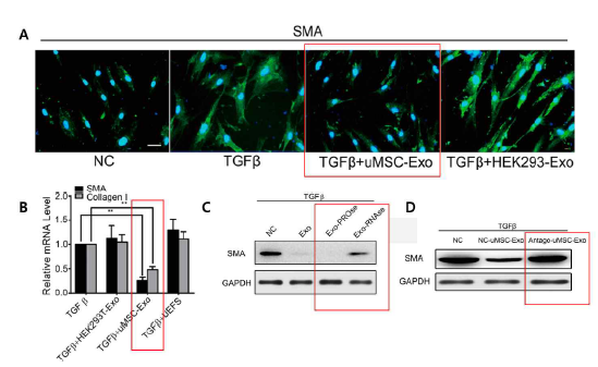 탯줄유래 중간엽 줄기세포에서 분리한 엑소좀 (uMSC-Exo)이 mouse skin fibroblast에서 fibrosis marker를 감소 시킴 (A, B). RNAse 에 의해 항 섬유화 효과가 소실되므로 엑소좀의 항 섬유화 효과는 단백질보다는 RNA 의존적임 (C). 항 섬유화 마이크로 RNAs에 대한 특이 antagomiRs 투여 실험을 통해 엑소좀의 항섬유화 작용이 특정 마이크로 RNAs 에 의한 것임을 보여줌 (D)