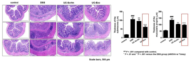 UC-exosome 투여 시 DSS 투여 군(섬유화 군)에 비해 submucosa, muscularis propria 두께가 유의하게 감소