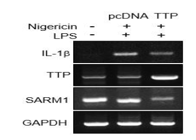 NLRP inflammasome활성시 TTP 에 의한 SARM1 발현 조절