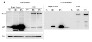 PGRN 과발현 HEK 293T 세포주에서 PGRN media 방출 확인