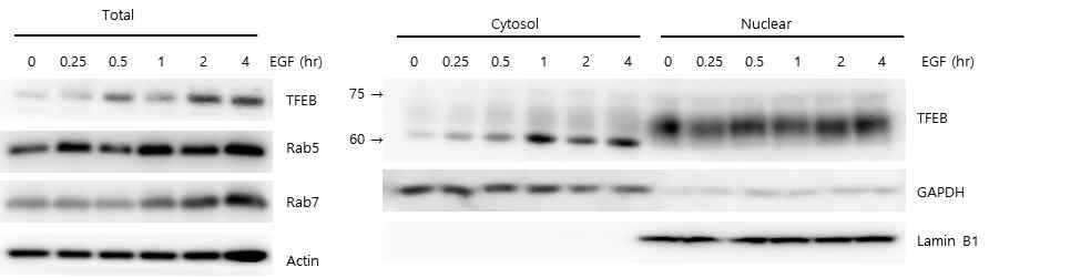 EGF에 의한 TFEB 발현 증가