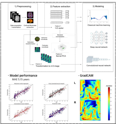뇌영상 데이터 기반 뇌연령 1차 모델