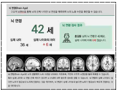 정상 노화 뇌연령 개별 추출