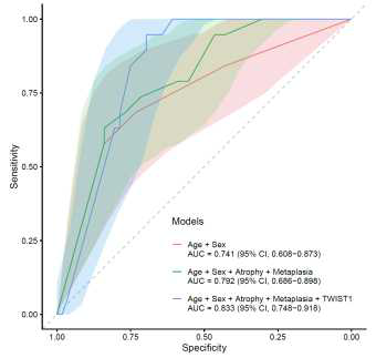 ROC curve