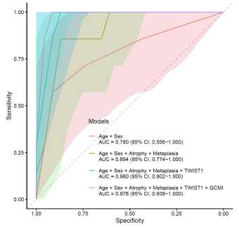 ROC curve