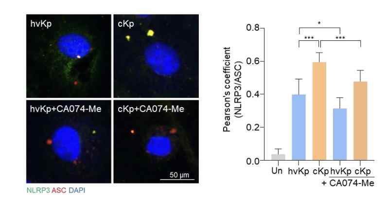 catepsin B inhibitor (CA074-Me)를 활용하여 confocal microscopy 로 NLRP3, ASC 확인 (NLRP3 (green), ASC (red), and DAPI (for nuclei))