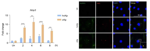 HvKP, cKP 감염 이후 Nlrp3 mRNA level 측정 및 confocal microscopy로 NLRP3, ASC 발현 확인
