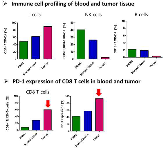 폐암 조직 및 환자 혈액의 면역세포의 조성 비교