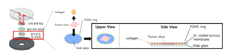 Microfluidic을 이용한 혈관-종양 조직 체외 모사 칩 제작