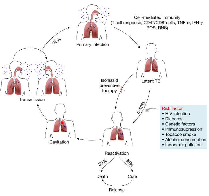M. tuberculosis 감염 진행단계 (Expert review, 2011)