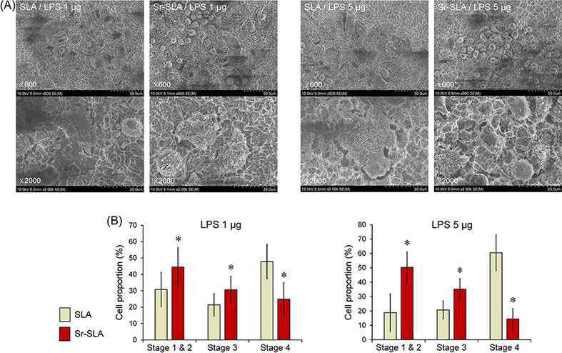 FE-SEM images & stages of spread macrophages