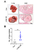 누드마우 스 실험을 통한 LCN2 과발현 세포 주의 폐 전이 능력 확인 결과(A, B)