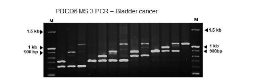PDCD6-MS3 방광암 환자에서 패턴 분석