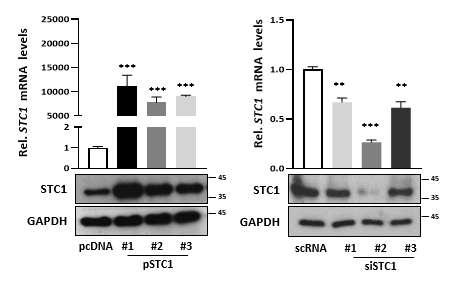 방광암 세포주에서의 STC1 발현에 따른 protein level 확인