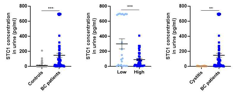 대조군 및 방광암 환자의 serum(A) 및 소변시료(B)를 통한 STC1 수준 측정