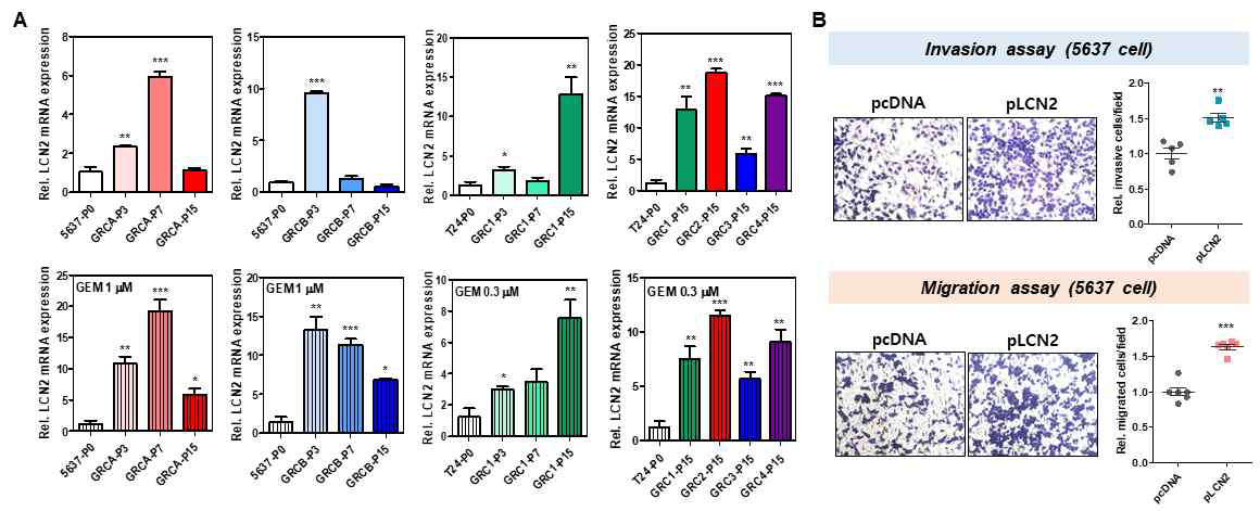 (A) 방광암 GRC 세포주에서 LCN2의 mRNA 발현 확인　 (B) LCN2의 과발현에 따른 세포 이동성의 변화 확인