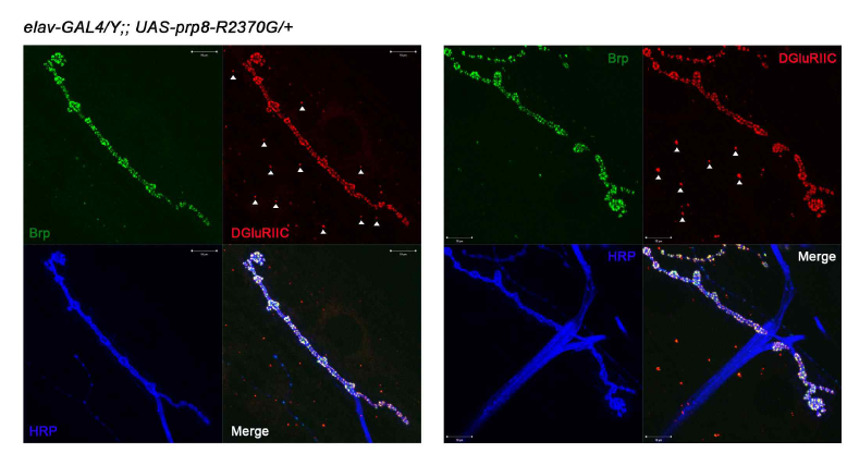 PRP8 R2370G 돌연변이가 과발현된 개체의 시냅스 구조 및 주요 시냅스 단백질(Brp, DGluRIIC)의 분포 양상(화살표, extrasynaptic glutamate receptor clusters)