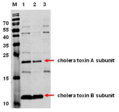 콜레라 균주의 독소 단백질 발현. M: molecular size marker, 1: 독소 발현 조건에서 배양된 IB5230(고병원성 콜레라 균주)의 배양액과 균체 전체, 2: 독소 발현조건에서 배양된 IB5230 (고병원성 콜레라 균주)의 배양액 분획, 3: 독소 발현 조건에서 배양 된 IB5230(고병원성 콜레라 균주)의 배양액을 제외한 균체