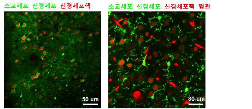소교세포와 신경세포 형광발현 확인
