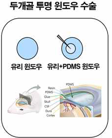 두개골 투명 윈도 우 도식도