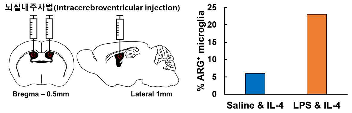 뇌실내주사법 도식도와 인터류킨4(Interleukin4, IL4) 주입 후 아르기아나제(ARG1) 발현 양상 변화