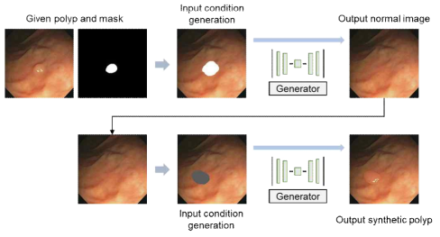 제안하는 실제 같은 비정상 용종이미지 생성기법 흐름도