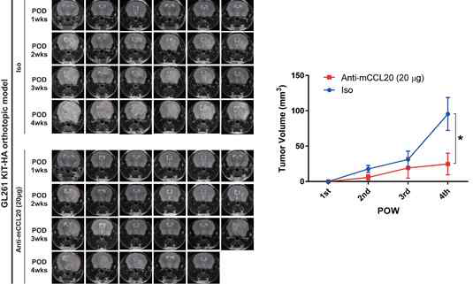 KITENIN 과발현 악성신경교종 모델에서 anti-CCL20에 종양형성 억제 규명