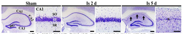 일과성 전뇌허혈 유발에 따른 해마 CA1영역에서 지연성 신경세포 사멸