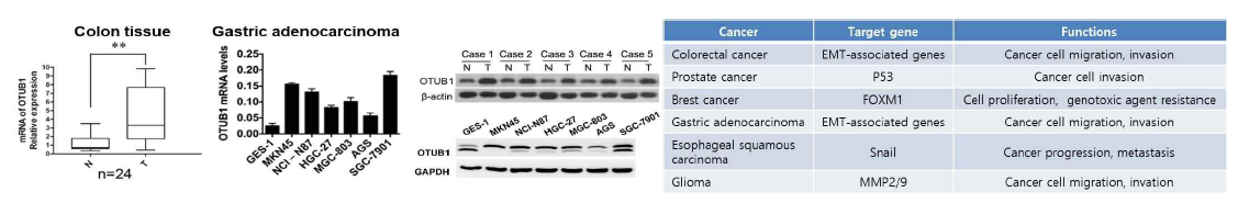 암세포에서 OTUB1의 발현