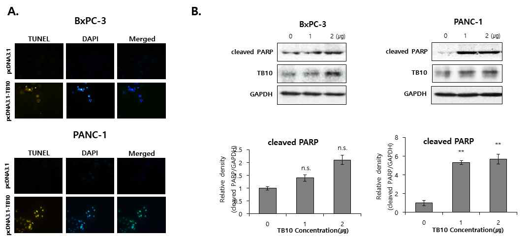 TB10 induces apoptosis in pancreatic cancer cells. BxPC-3 and PANC-1 cells were transiently transfected with pcDNA3.1 or pcDNA3.1-TB10 for 48 hours. (A) DAPI staining was performed and Images were captured on a fluorescence microscope. (B) Cleaved PARP were determined using western blot assay
