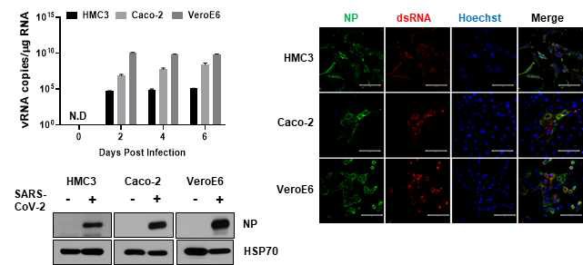 human microglia (HMC3) 에 SARS-CoV-2 의 감염