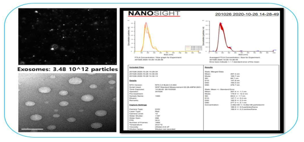 대량 생산한 엑소좀의charcterization완료