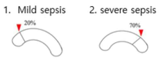 mouse severity 조절 방법 도식화