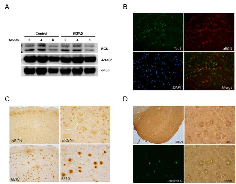 정상 및 5XFAXD mice의 대뇌조직에 있어 regucalcin 단백질의 발현