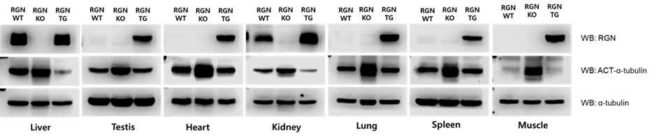 RGN wt, KO 및 Tg mice에 있어 장기별 regucalcin과 acetylated α-tubulin의 발현비교