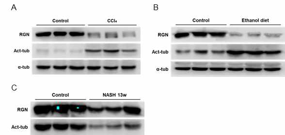 다양한 간질환모델에 있어 regucalcin과 acetylated tubulin발현양상