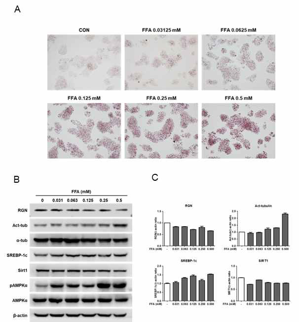 FFA 지방축적 간세포모델에 있어 regucalcin, acetylated tubulin 및 지방대사단백질 발현비교