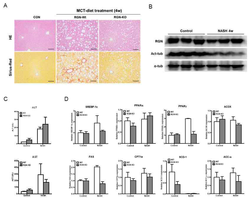 MCT-diet유발 지방간염모델에 있어 regucalcin, acetylated tubulin 및 지방대사단백질 발현비교