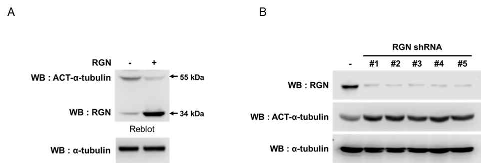 RGN 과발현 및 sh-RNA viral particle을 이용한 stable cell에서의 acetylatated tubulin 발현양상