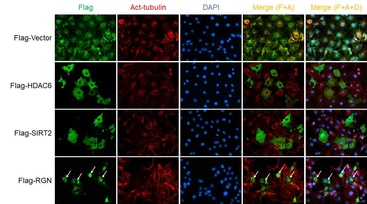 Regucalcin, HDAC6, SIRT2의 subcellular localization과 acetylated tubulin발현비교