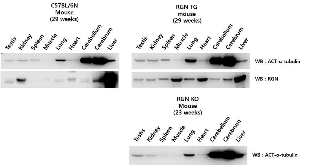 C57BL/6N, RGN TG 및 RGN KO에 있어 acetylated tubulin과 RGN발현비교