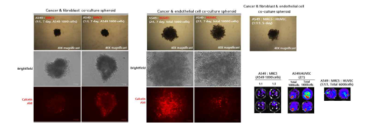 세포 유형별, 비율별 공동배양 5~7일 후 MTCs(multi cell tumor spheroid)형태 이미지