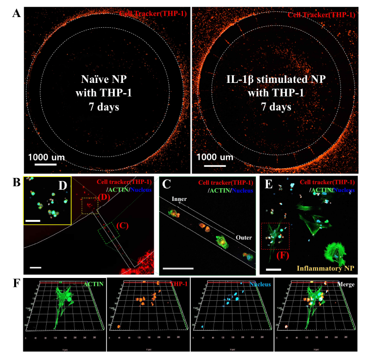 A. 3차원 추간판 배양체 및 단핵구 세포 공배양을 통한 상호작용 (7일 공동배양) B. C, D, E THP-1 단핵 구 세포의 채널을 통한 migration (7일 공동배양) F. 수핵 세포 및 단핵구 세포 상호작용