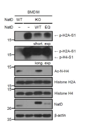 NatD-WT 및 NatD-EQ 과발현에 따른 히스톤 H4의 아세틸화 및 인산화 분석